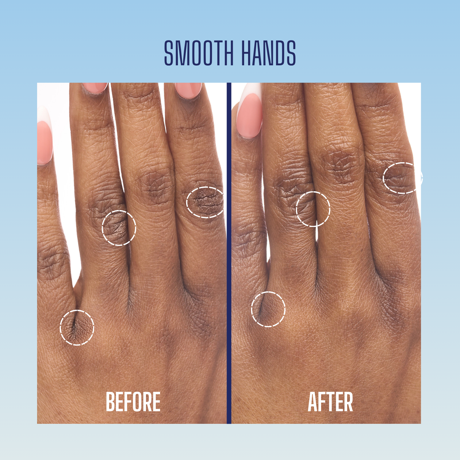 Smooth Hands